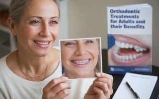 Les traitements d’orthodontie pour adultes et leurs bénéfices