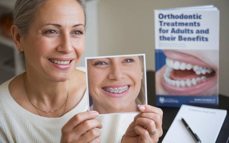 Les traitements d’orthodontie pour adultes et leurs bénéfices