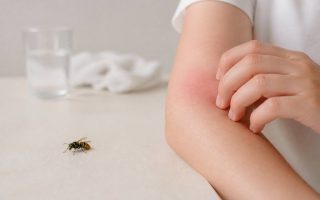 Allergie piqûre de guêpe : symptômes, risques et conduite à tenir